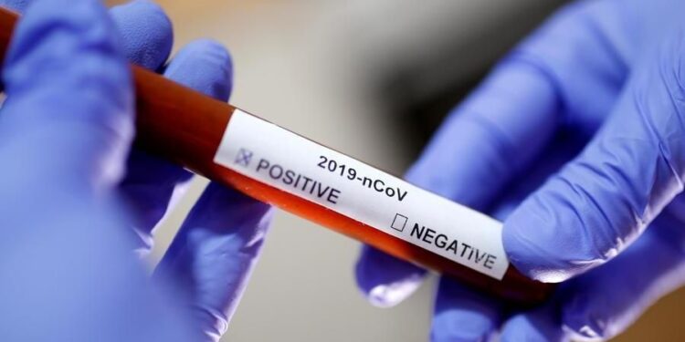 Circola nonostante il tampone positivo, denunciato