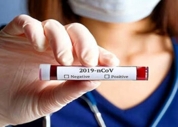 Contagi, -35% in una settimana