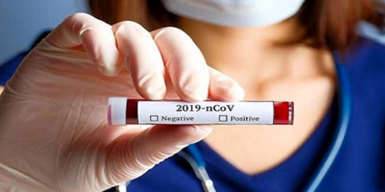 Contagi, -35% in una settimana