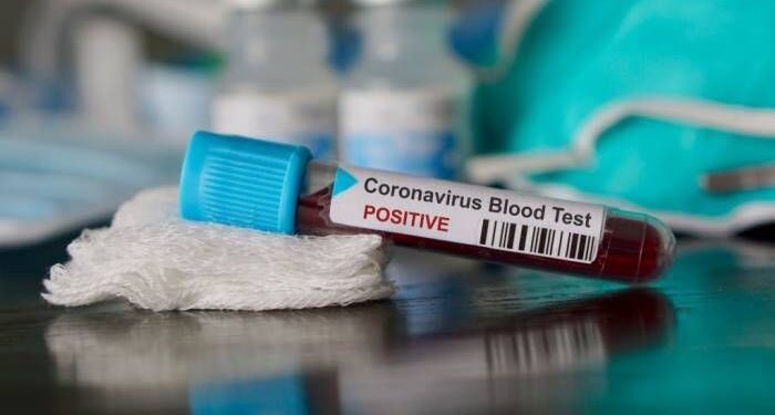 Coronavirus, 76 morti in Fvg