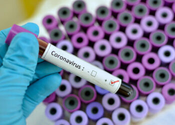 Coronavirus: i casi positivi salgono a 22