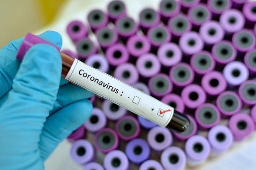 Coronavirus: i casi positivi salgono a 22