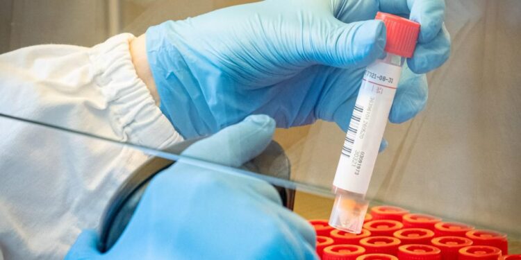 Covid, in Fvg non rilevate le varianti “brasiliana” e “sudafricana”