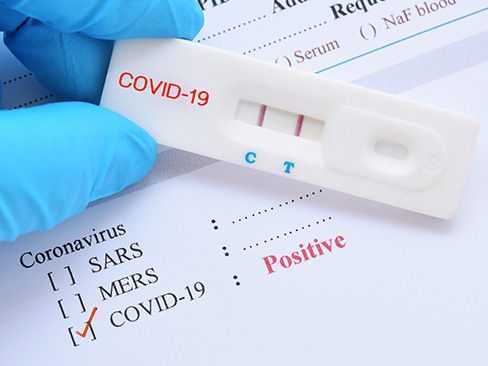 Covid, oggi in Fvg altri 5.514 positività