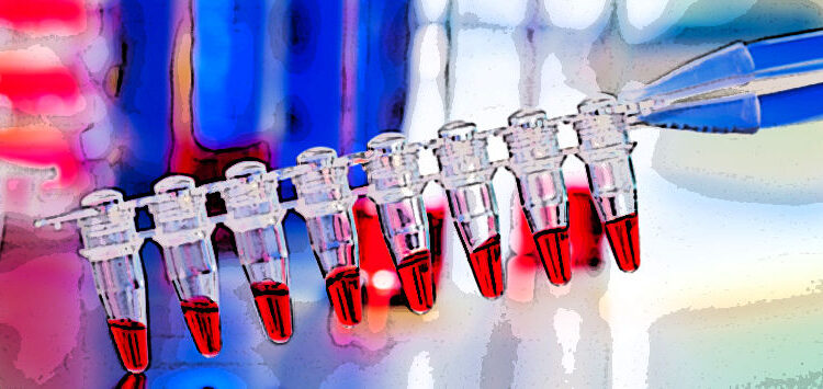 Farmaci innovativi, Fvg detiene il record per tempi di acquisto