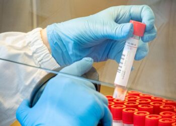 Il Fvg torna in “zona gialla”