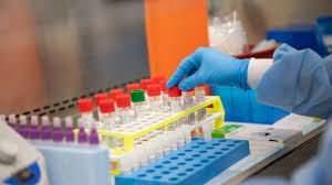 Regione, in Fvg 655 casi, 38 i morti