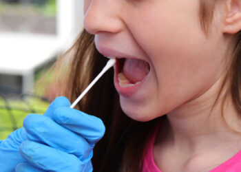 Test salivari molecolari validi per il green pass