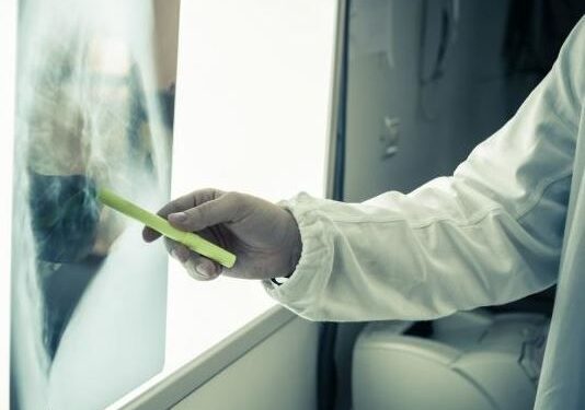 Tumori, tra gli uomini oltre 2000 nuovi casi l’anno in provincia di Udine