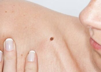 Moruzzo, visite gratuite con la Lilt per prevenire il cancro