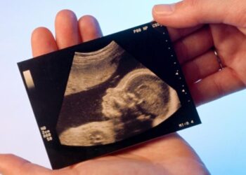 I figli sono soggetto di diritti, non oggetto di quelli altrui