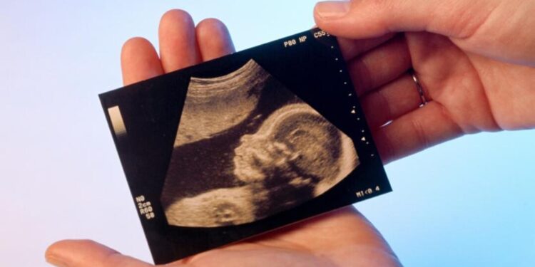 I figli sono soggetto di diritti, non oggetto di quelli altrui