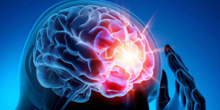 Epilessia, oltre lo stigma. Informazioni a S. Valentino in via Pracchiuso