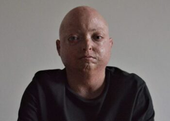 Al via a Cervignano Borderland/Orizzonti, 20 anni di arte contemporanea in Fvg