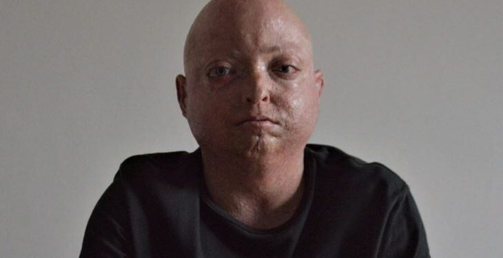 Al via a Cervignano Borderland/Orizzonti, 20 anni di arte contemporanea in Fvg